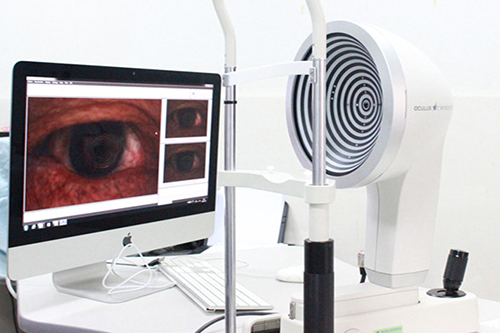 干眼特色门诊简介_广州眼科医院_广州最好的眼科医院