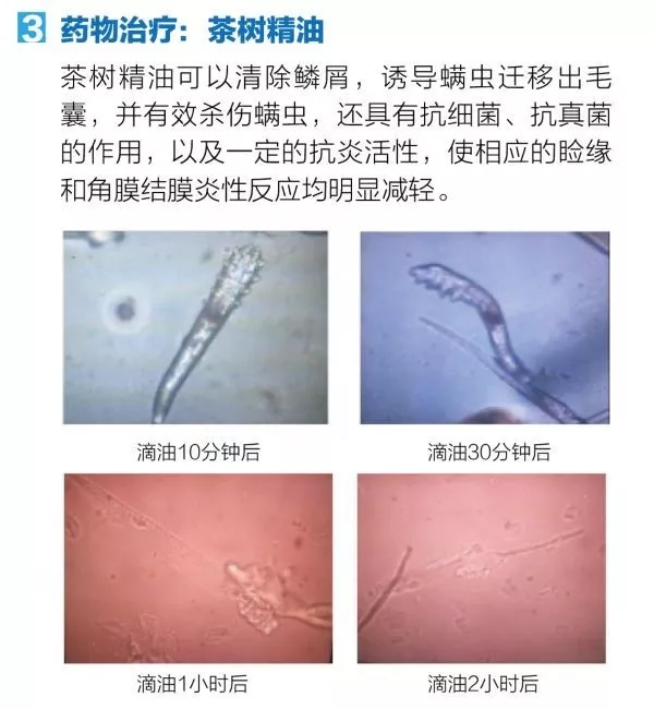 1558422571182994.png 图片9.png