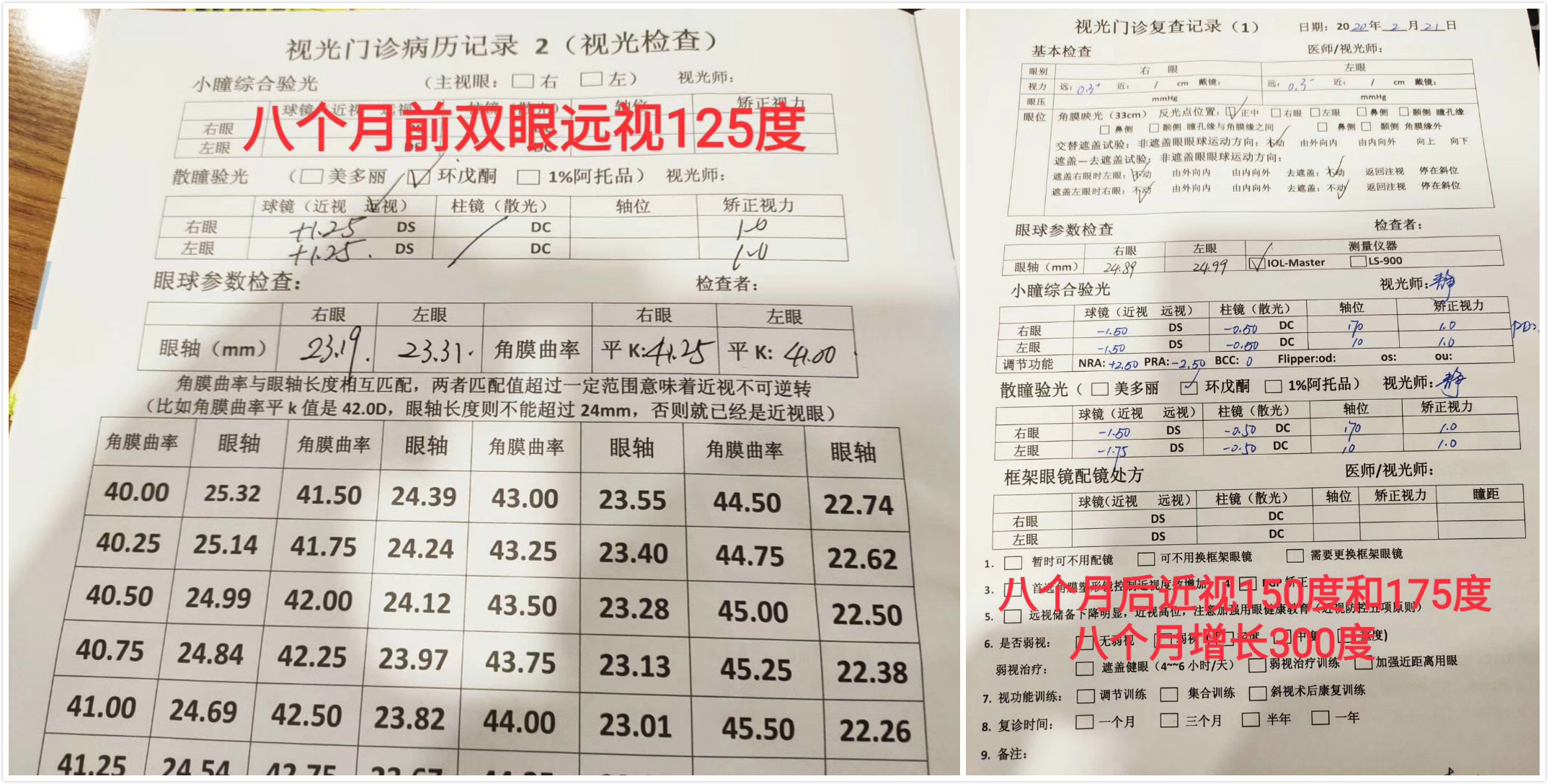 1582679740549098.jpg 小武的屈光发育档案及复查结果.jpg