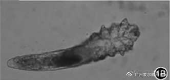 ▲显微镜下的蠕形螨